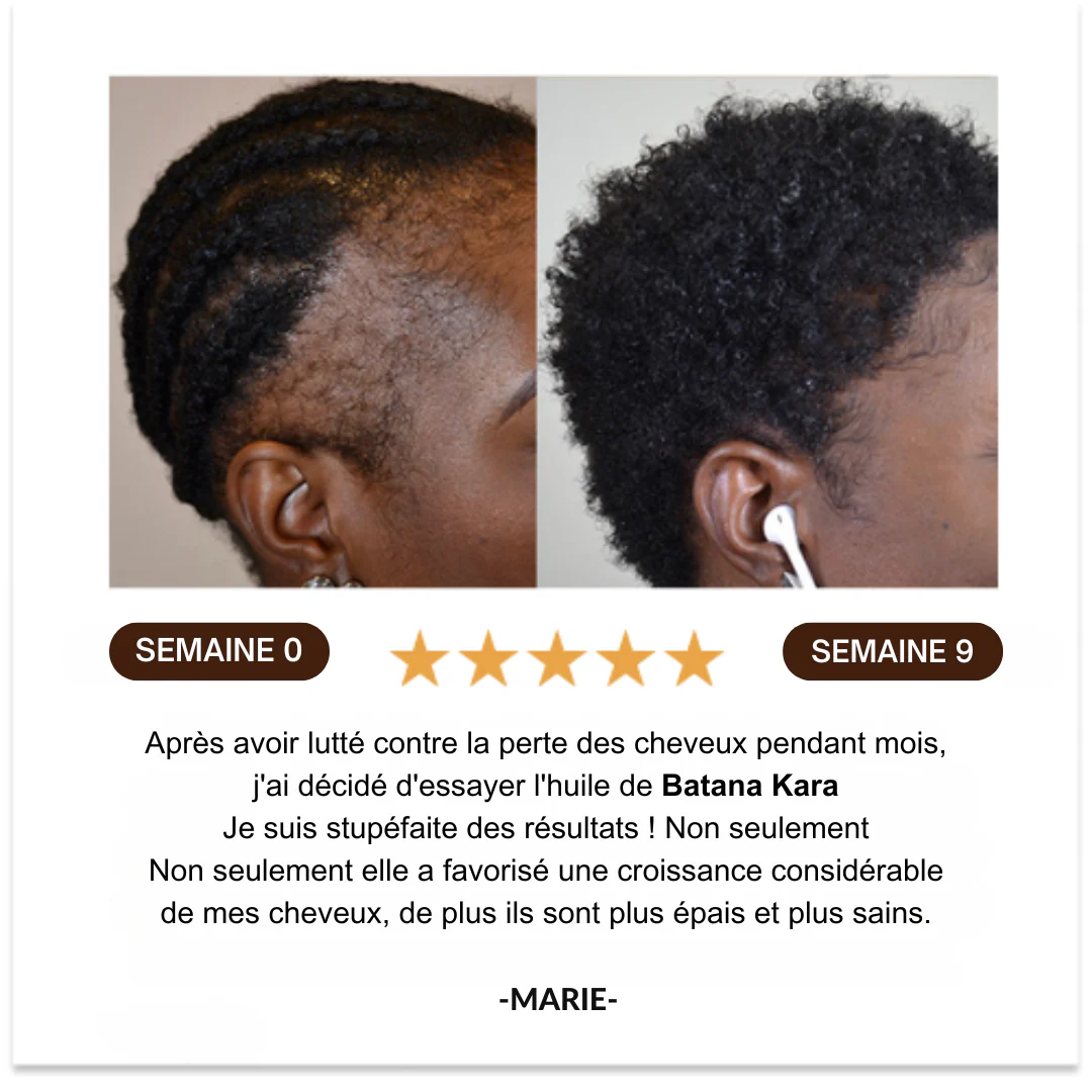 Huile de Batana™ 100% pure | L'huile de croissance des cheveux, de traitement capillaire pour tous les types de cheveux
